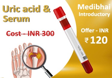 Uric Acid Test