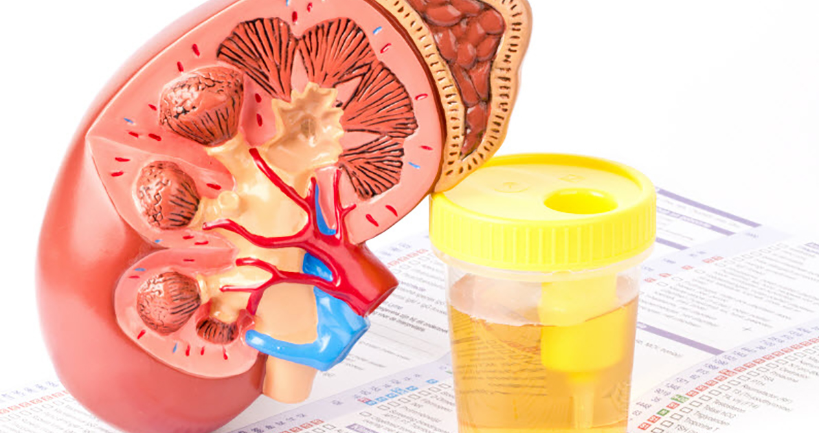 Kidney