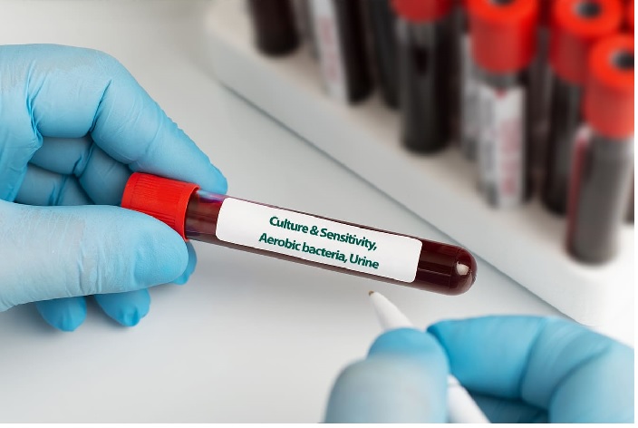 Culture & Sensitivity, Aerobic bacteria, Urine