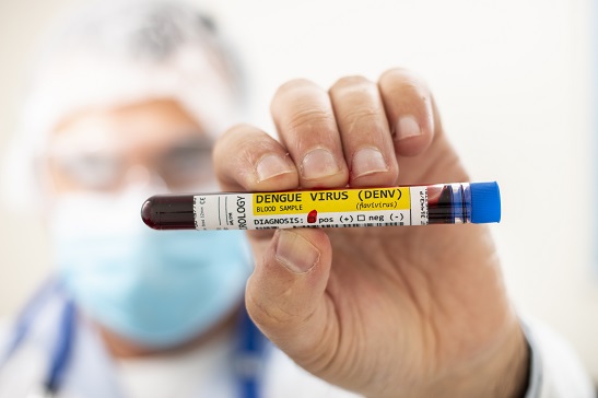 Dengue IgG antibody - RAPID Card