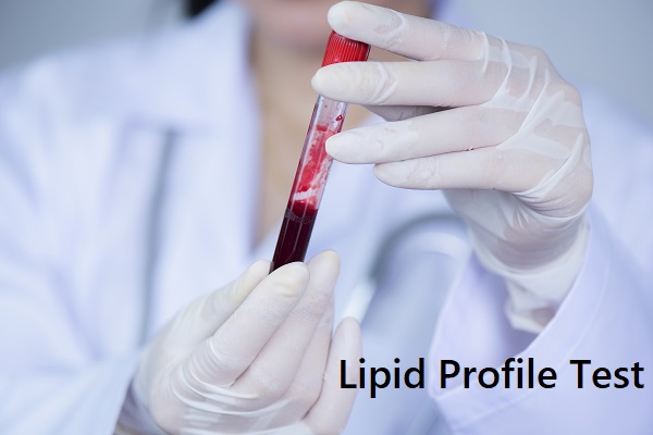 Lipid Profile
