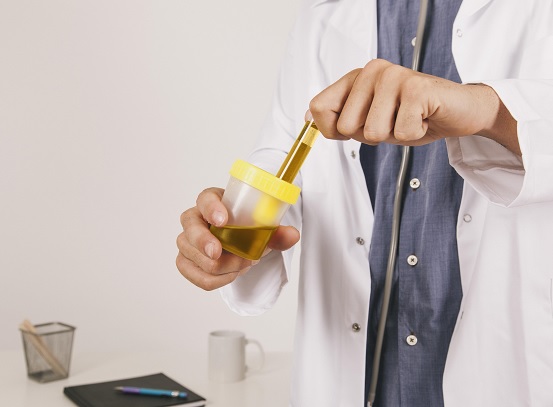 Urine Routine & Microscopy